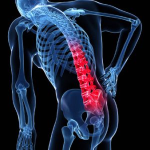 antalgia acute disc injury