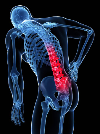 antalgia acute disc injury