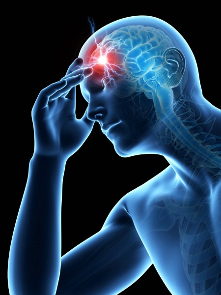 Frontal Headache