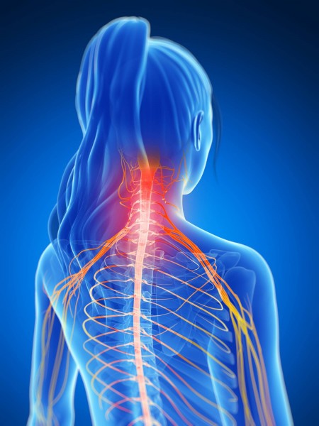 Neck pain spreading to shoulders
