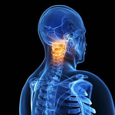 neck pain treatment gold coast