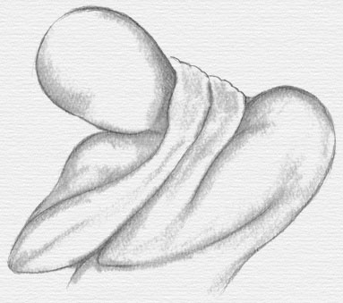 Neck Pain