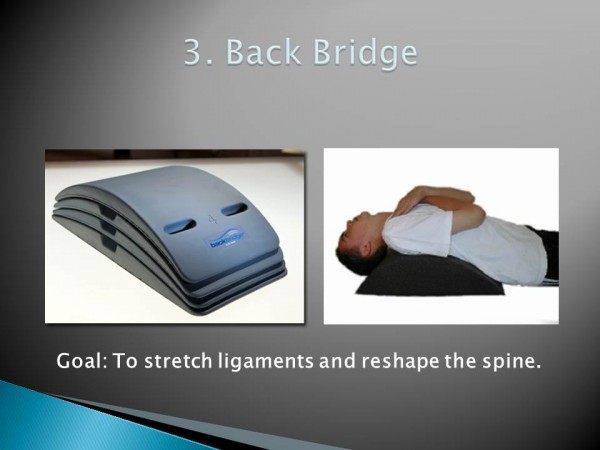 chiropractor gold coast