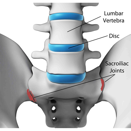 Sacroiliac Joint Dysfunction