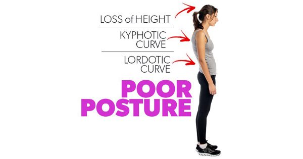 improve poor posture